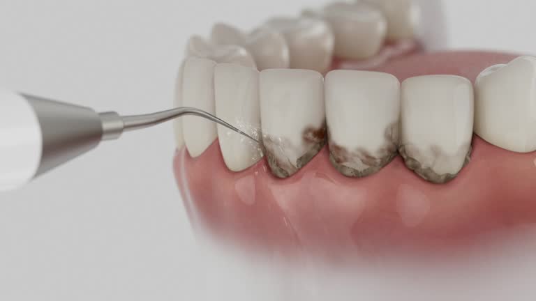 Reliable Dental contractor in Fairview, MT by Smile Center Dentistry